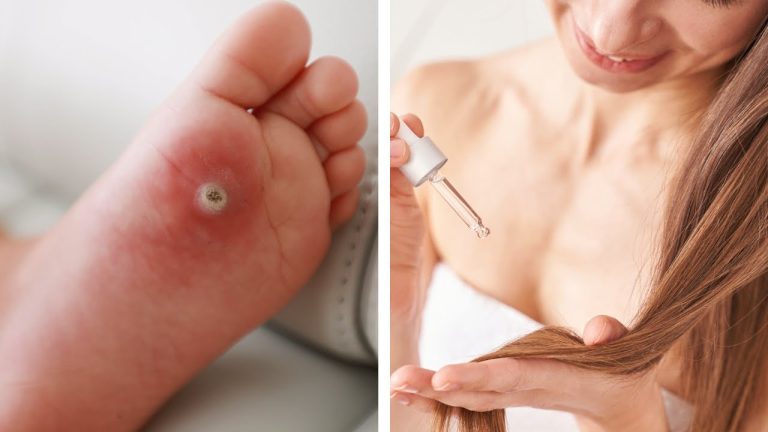 Cheap And Powerful: Castor Oil's Surprising Health Benefits!