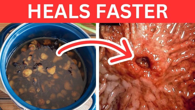 This Tea Can Heal Your Stomach, Relieve Pain, Relieve Stress and More