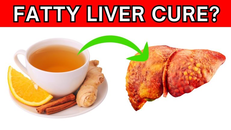 Discover the Ultimate Natural Remedy: Drink This Tea Daily to Cure Fatty Liver Drink This Tea Daily to Fix Fatty Liver Naturally
